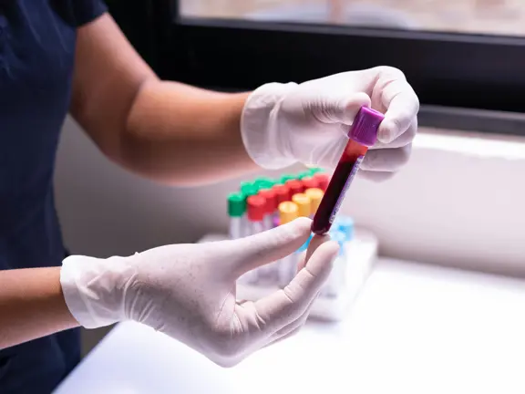 Nurse holding a blood vial for testing